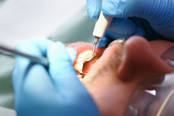 Best Knocked-Out Tooth Emergency  in New Albany, MS